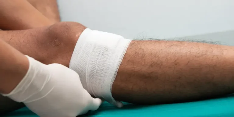 How To Heal Leg Ulcers And Restore Skin Integrity