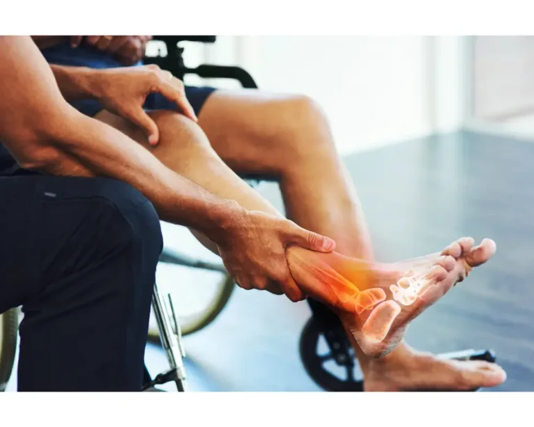 Threaded Healing: The Intricate Role Of Surgical Screws In Foot