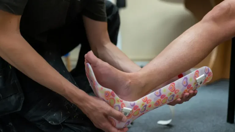 Foot Braces Decoded: Your Key To Happy, Healthy Feet!