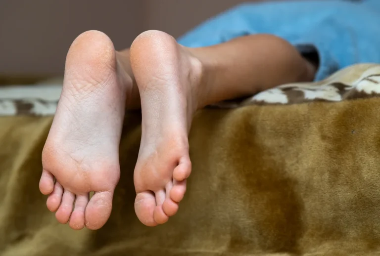 What Is Morton Neuroma and Treatment for Morton’s Neuroma