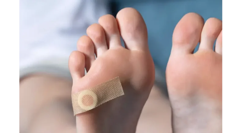 Understanding Plantar Warts: Those Unwanted Visitors On Your Feet