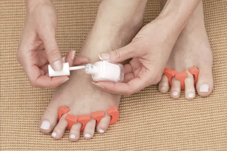 How to Have Successful Treatment of Toenail Fungus
