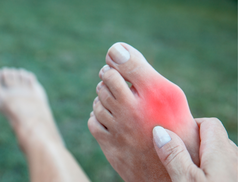Bunions & Lapiplasty