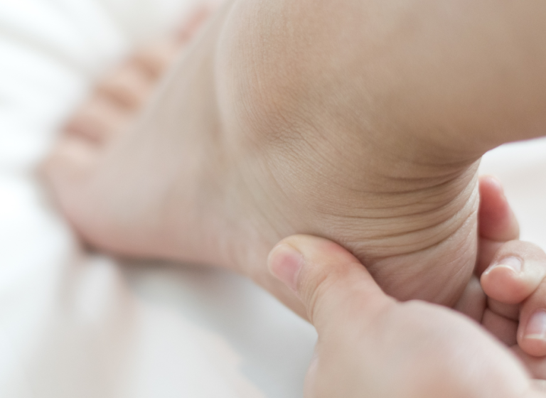 Plantar vs. Posterior Heel Pain: Understanding the Difference